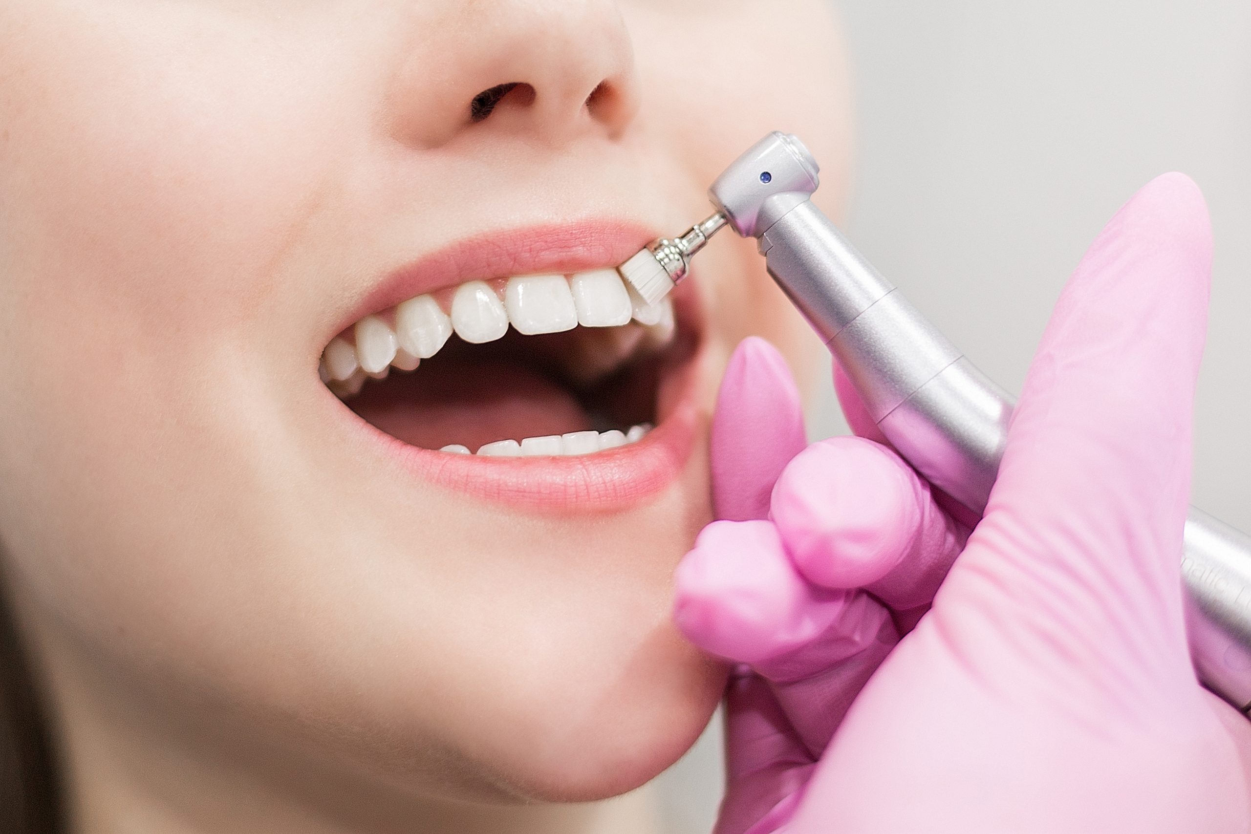 Dentist Brushes Teeth Young Girl Teeth Whitening 2023 11 27 05 33 35 Utc