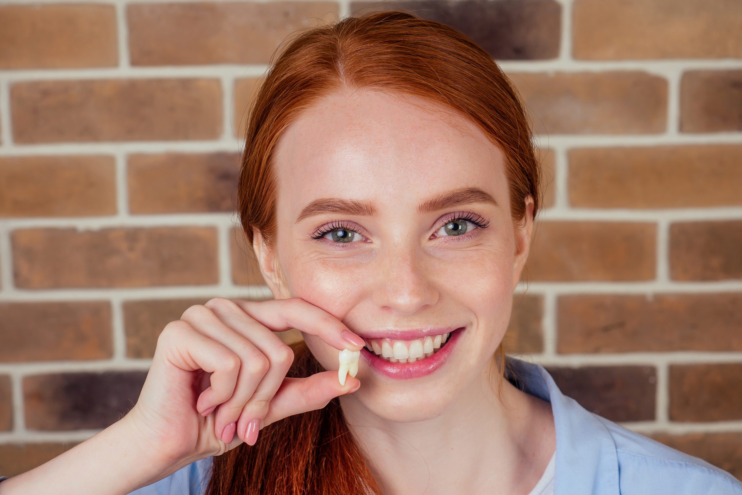 Redhaired Ginger Female With Snow White Smile Holding White Wisdom Tooth After Surgery Removal Of A Tooth